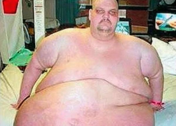 6 удивительных историй похудения, в которые сложно поверить